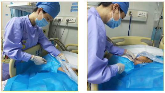 四川省中西医结合医院重症医学科十二指肠空肠营养管安置术